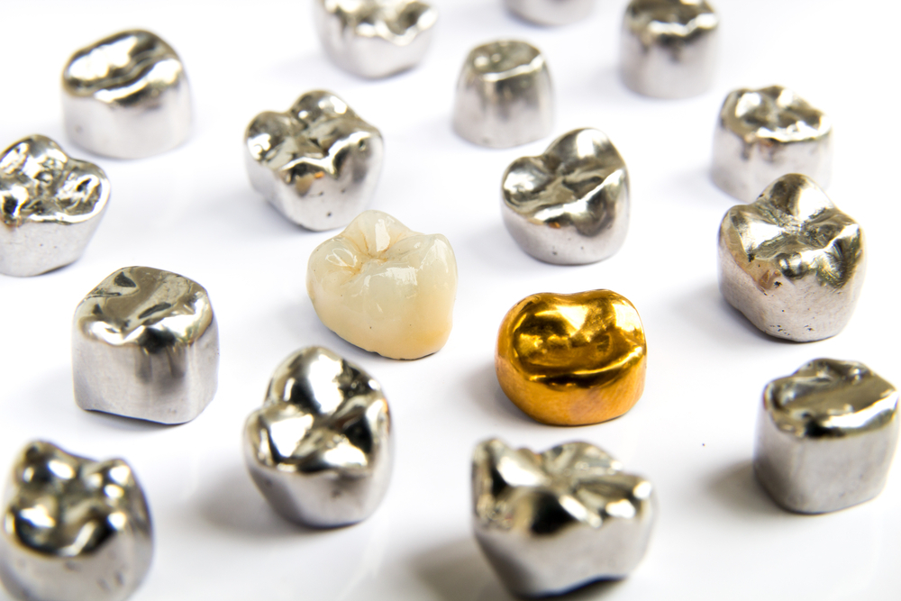Stainless steel dental crowns on teeth model